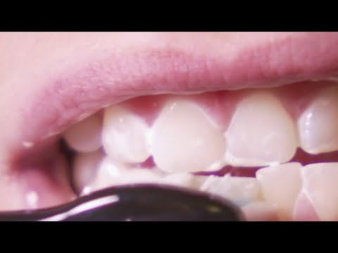 Vidéo: Comment La Nourriture Affecte-t-elle La Santé Dentaire Des Chiens ? - Les Aliments Peuvent-ils Garder Les Dents Des Chiens En Bonne Santé ?