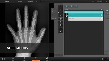 3DISC QuantorMed  Imaging Software Intro   10Youtube com