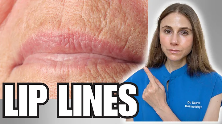 How to Get Rid of Smoker’s Lines | Dermatologist Explains Causes & Treatments
