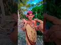 Gaurav ko injection kyu laga #shorts #gauravaroravlogs #youtubeshorts PM1689