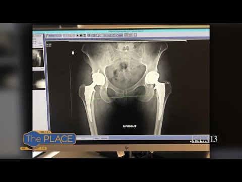 Hip replacement in younger patients