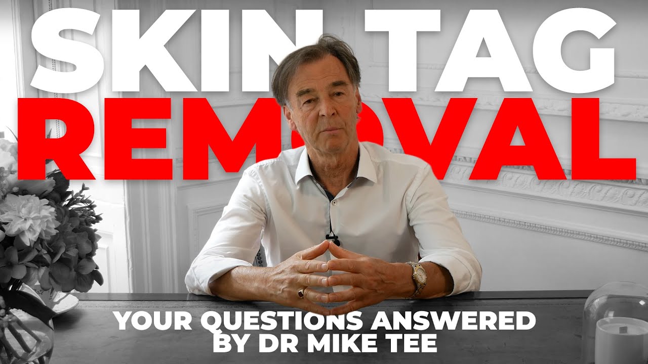 A Doctor Answers All YOUR Questions About Skin Tags