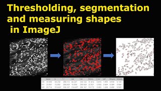 Thresholding segmentation and measuring shapes in ImageJ