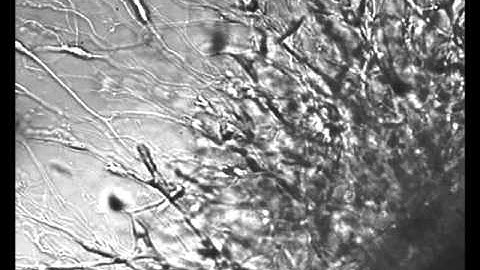 Nerve Regeneration in fibrin-based hydrogels