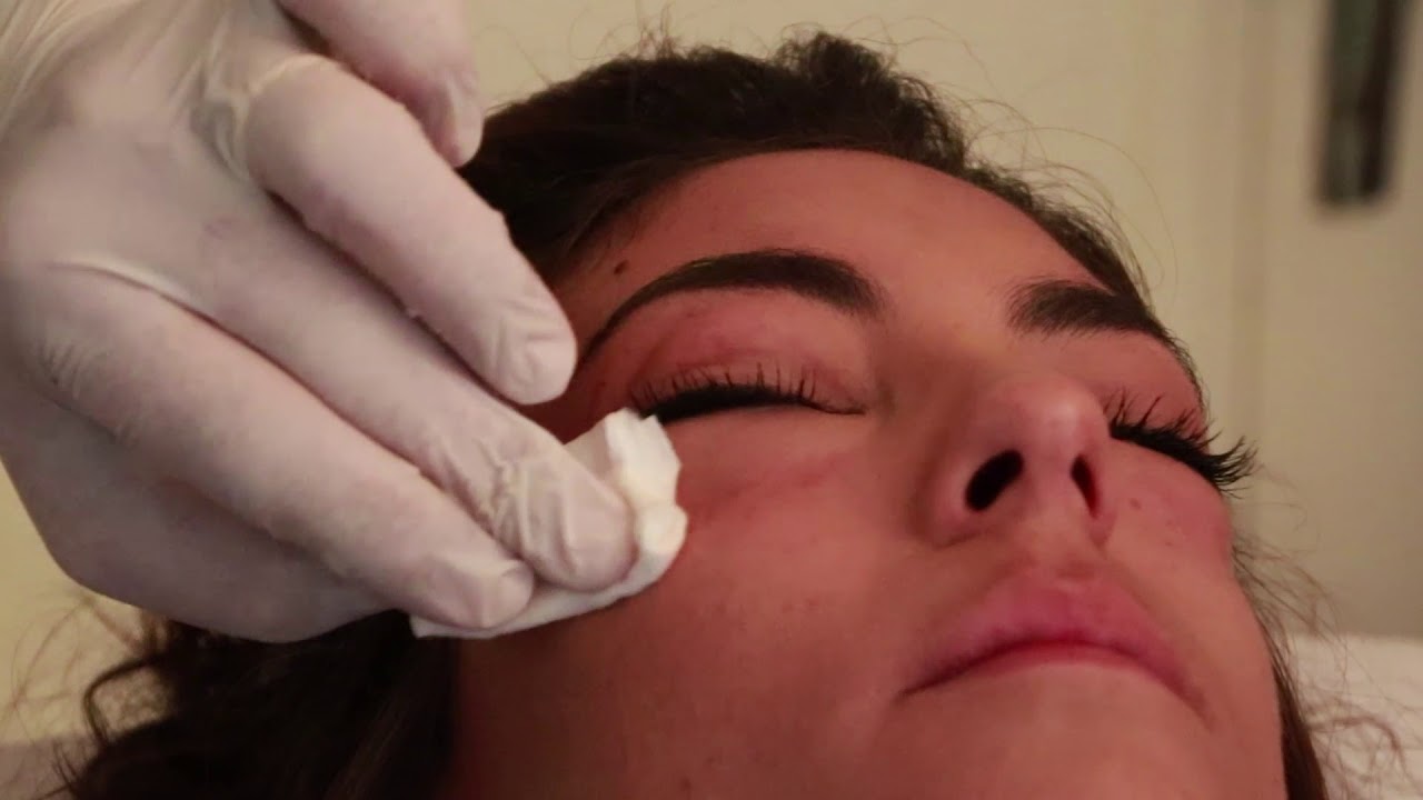 Carboxythérapie cernes & Ovale du visage - CMEL