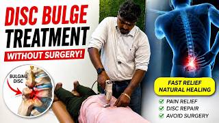 Disc bulge treatment - without surgery #chiropractor #nonsurgical