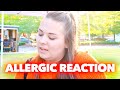 NO!!! ( Allergic Reaction)| Family 5 Vlogs