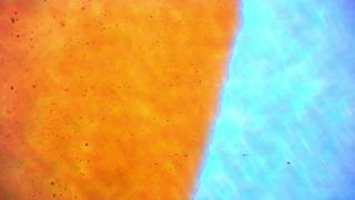 Bacteria in expired food coloring (real image)