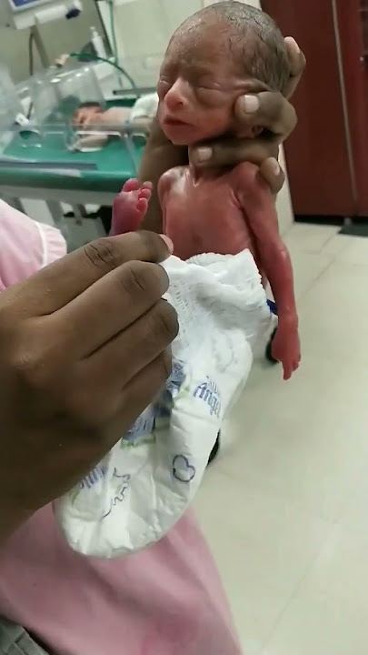 baby of five months  ##weight 400grams ## male baby #soo cute small baby##baby is serious plz help 🙏