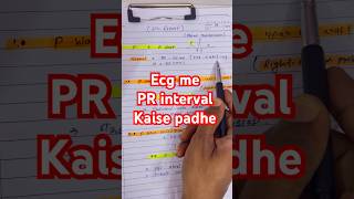 Pr interval #printeval #tendersudhir #printerval #ecgkaisepadhe