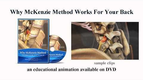 "Why McKenzie Method Works for Your Back" Animation Trailer.wmv
