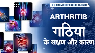 Joint Pain या जोड़ो में दर्द का Permanent Treatment | घुटनो में दर्द का इलाज | Osteoarthritis | GOUT