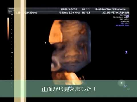赤ちゃんの産み分けと中絶について質問したいです - 妻は妊娠して2ヶ月になりま... - Yahoo!知恵袋
