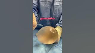 This is Why Gummy Bear Implants Are the Best 👍 #shorts