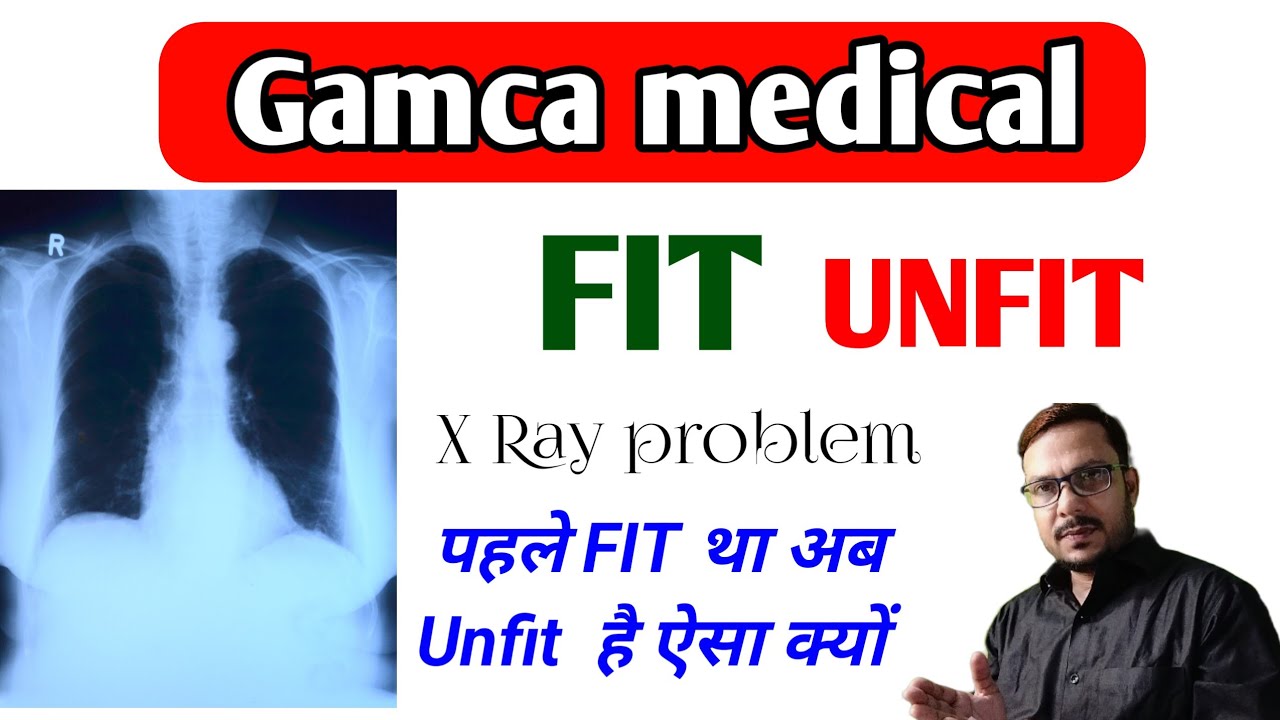 Gamca medical पहले Fit था अब Unfit कैसे होगया Chest X RAY problem in