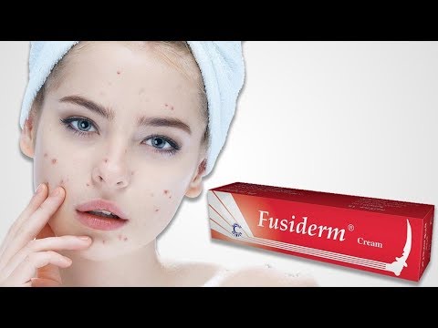 Video: Fusiderm - Lietošanas Instrukcija, Cena, Atsauksmes, Krēms, Ziede, želeja