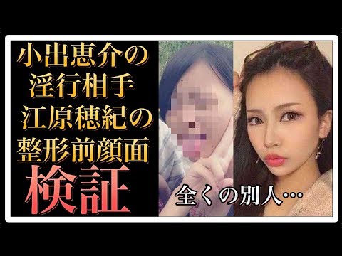 【衝撃】江原穂紀の整形前のインスタ画像を検証！母親も在日韓国人で生活保護？ 【World Scoop】