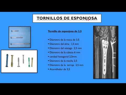 RECONOCE LOS TORNILLOS DE LA OSTEOSÍNTESIS, TORNILLOS DE ESPONJOSA Y CANULADOS. (2° parte)