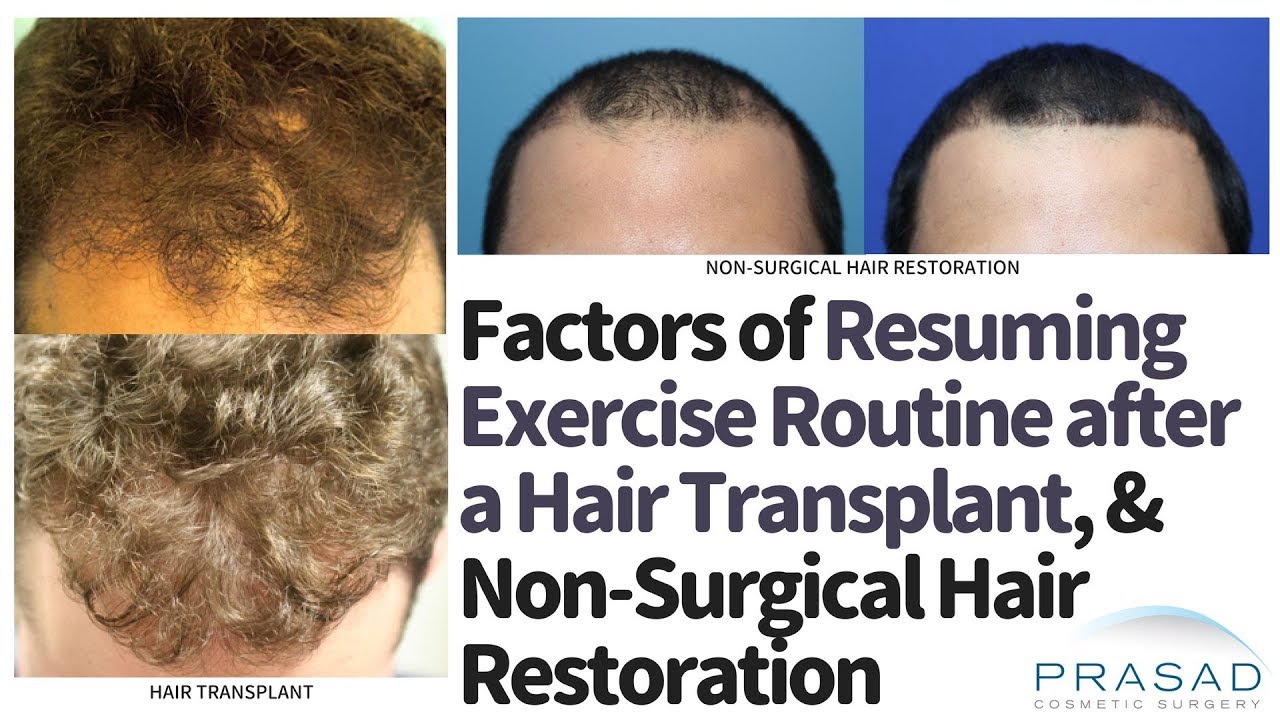 Factors in Resuming Exercise after a Hair Transplant, and Faster Return  from Non-Surgical Treatment - YouTube