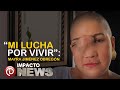 Impacto News-Mayra Jiménez-Cáncer en el rostro.