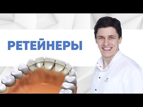 Ретейнеры после ортодонтического лечения.Несьемный ретейнер и ортодонтическая каппа.Зачем ретейнер?