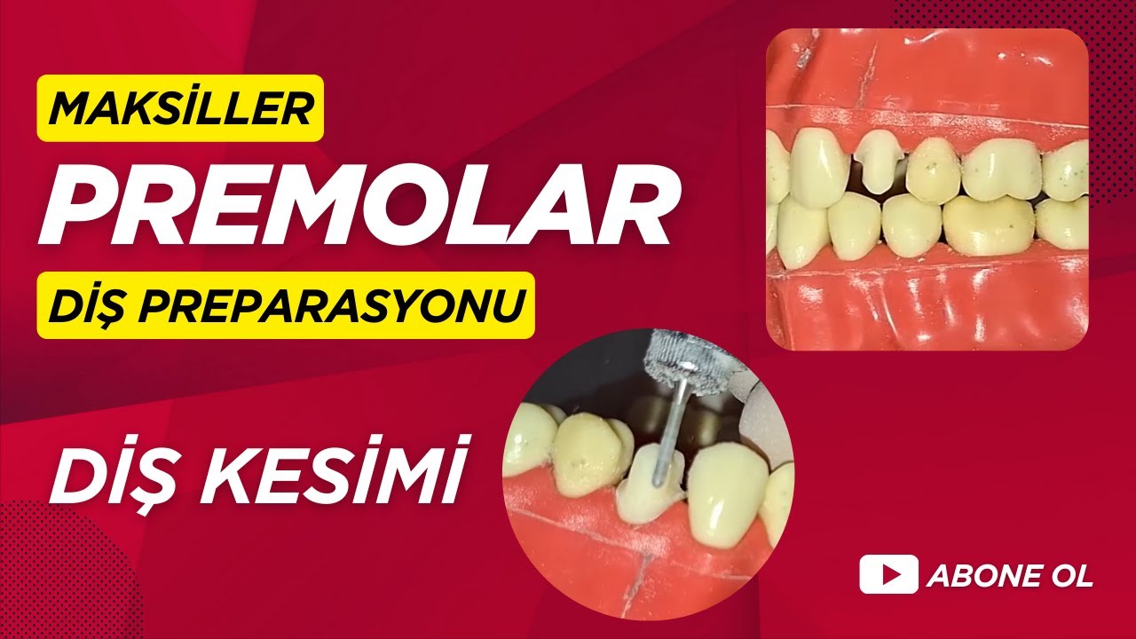 Maksiller Premolar Diş Preparasyonu