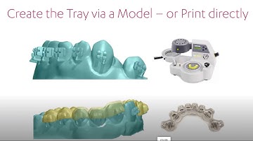 3Shape Trios Indirect Bonding IDB https://www.straightsmilesolutions.com/