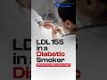 High LDL Case Discussion | Medicine MCQ Flashcard