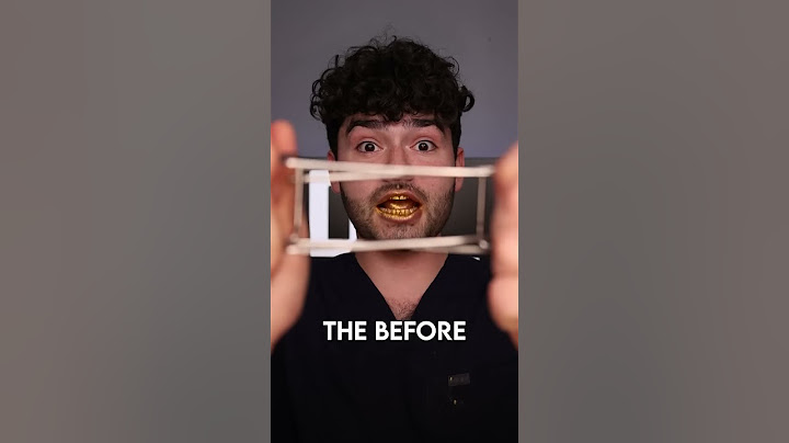 Gold ASMR Snacks vs Cavities !?