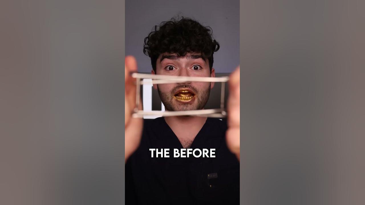 Gold ASMR Snacks vs Cavities !?