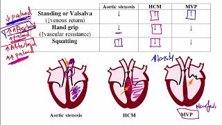 200 - Heart murmur, Aortic Stenosis, Hypertrophic cardiomyopathy, and etc. USMLE STEP 1 ACE