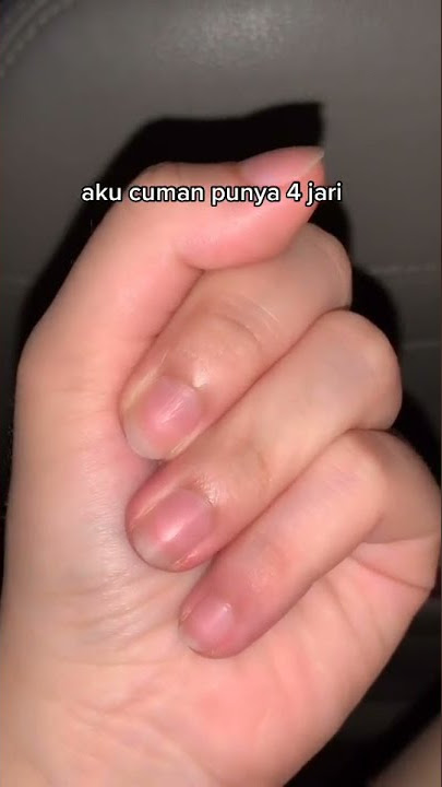 jari nya kok ada 4 sih |• ayo tebak satu lagi dimana?