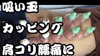 吸い玉【カッピング】療法のご紹介