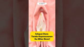 Selaput Dara Tanda Keperawanan Itu Mitos Besar