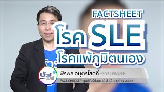 ชัวร์ก่อนแชร์ FACTSHEET :  โรค SLE หรือ โรคแพ้ภูมิตนเอง