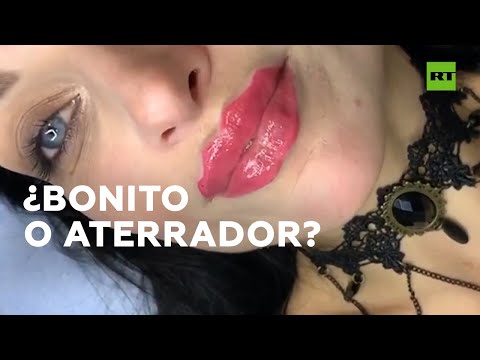 Video: Labios Del Diablo: El Doctor Comentó Sobre La Nueva Tendencia