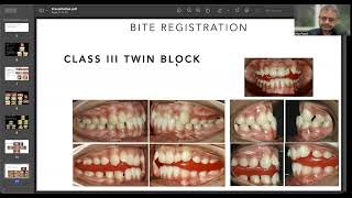 Orthodontic Finish Line 2025 | Twin Block – Prof. Dr. Dilip Patel | IOS | MCODS Mangalore | MOSG screenshot 4