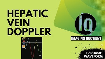 Hepatic vein doppler|| ultrasound doppler liver hepatic vein||Gastrointestinal radiology