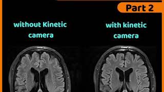 Kinetic MRI motion correction