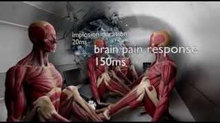 Explosive Animation: Human Bodies vs. Titan Submersible