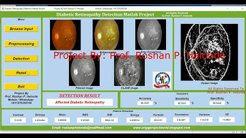 Diabetic Retinopathy Detection Image Processing Using Matlab Project| Final Year IEEE Project Code
