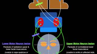 Facial Palsy Upper and Lower Motor Neuron Lesions - Dr  MDM