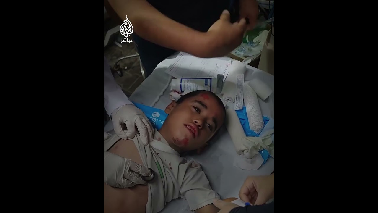 طفل يرتجف ألمًا بعد تعرضه لإصابة في قصف إسرائيلي