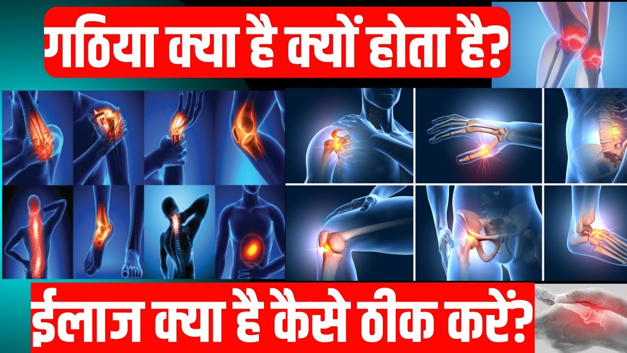 gathiya kya hota hai rheumatoid arthritis treatment gathiya kaise