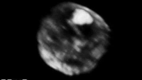 3D Video images of HIV Transfer between T cells through virological synapses