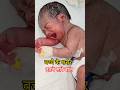 Lenugo Hair #shorts #youtubeshorts #nurse #nursing #healthtips #medical #newborn #hair #hospital