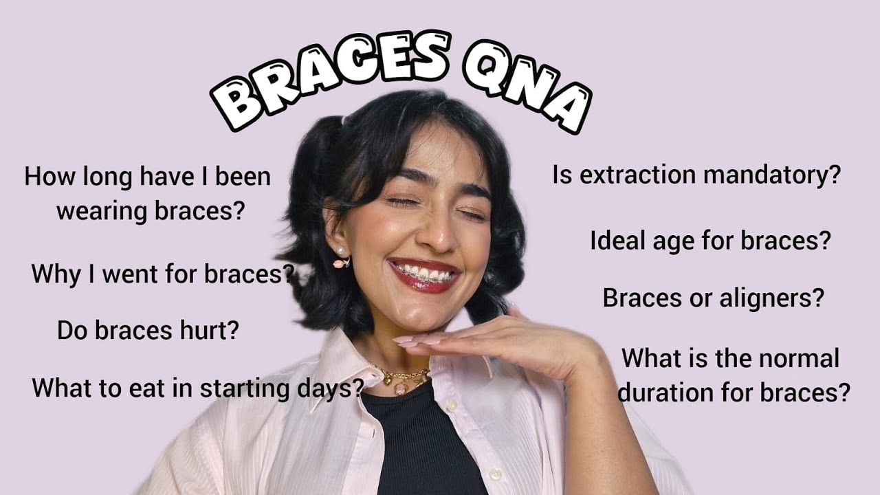 Everything you need to know about braces | Braces QnA 🦷 - YouTube