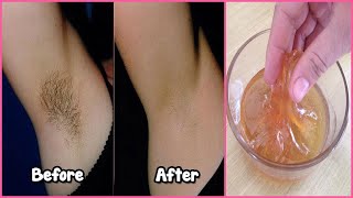 How to Remove Underarm Hair With Simple Ingredients | Underarms Hair Remove Permanently at Home