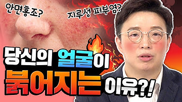 안면홍조의 관한 모든 것!? "얼굴이 붉어지는 원인과 종류는!?" #지루성피부염 #피부과전문의  ㅣ 피부 트래블러 Dr. 노