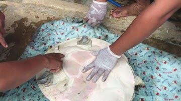 Finding the Vein for Taking Blood from a Cantor